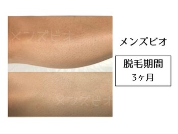 メンズビオ 神戸三宮店/