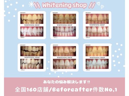 ホワイトニングショップ あおもり新町店の写真