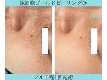 リメイククリニカルビューティー(Remake clinical beauty)/