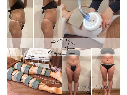 ミ ライト(m light)の写真