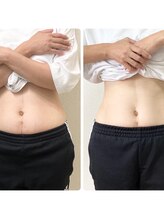 飯能ひだまり整骨院/美容整体・ウエスト－５cm♪