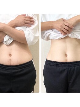 飯能ひだまり整骨院/美容整体・ウエスト-5cm♪