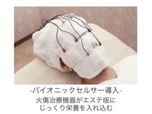 ステラ(Stella)/【バイオニックセルサー】導入機