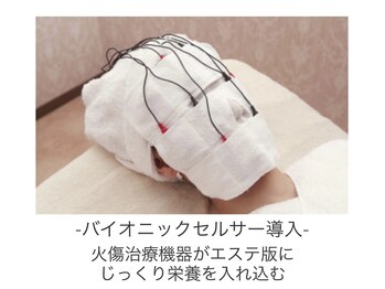 ステラ(Stella)/【バイオニックセルサー】導入機