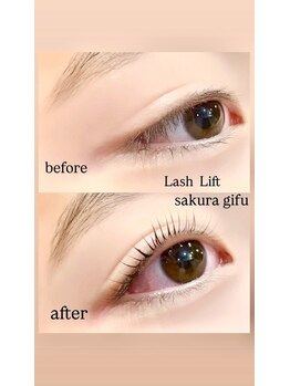 サクラ(SAKURA)/メーテルラッシュリフト