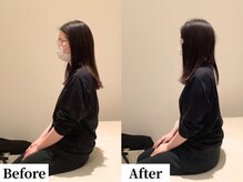 ソレア(Solea)/首こり・腰痛改善1回目