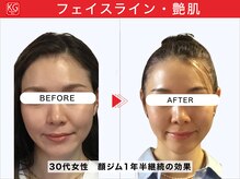 那賀洋子式 顔ジム 大分戸次店/30代女性、1年半継続の効果