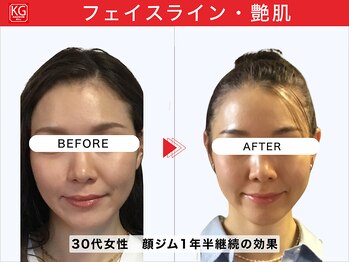 那賀洋子式 顔ジム 大分戸次店/30代女性、1年半継続の効果