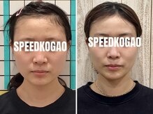 スピード小顔 渋谷店 (Speed)