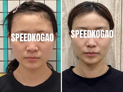スピード小顔 渋谷店 (Speed)の写真