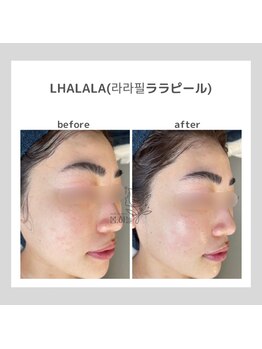 ポムハヌル(pom.haneul)/韓国肌管理室