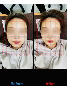 大久保ひまわり整骨院/~小顔矯正~