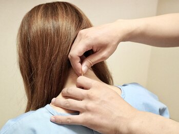 TK鍼灸院/東洋式鍼灸