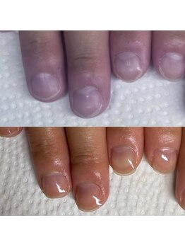 ウェルズユキ(well's yuki)/3回目で変化した爪/自爪ケア