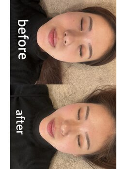 マホロバ(mahoroba)/美容鍼+EMS/鍼灸サロンmahoroba