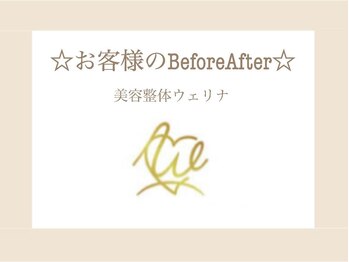 美容整体ウェリナ 名駅院/7.【小顔矯正before→after】
