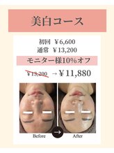 ナーズ(NAZ)/美白コース