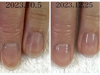 ナオ(nao)の写真