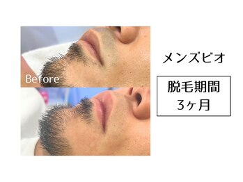 メンズビオ 神戸三宮店/