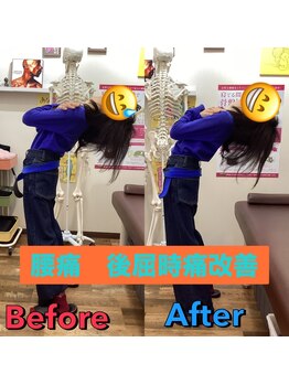 ヒデ整体院(Hide整体院)/猫背矯正骨盤矯正B/A肩こり腰痛