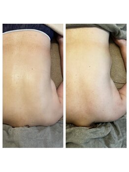 美温(mion)/肩甲骨を正しい位置へ