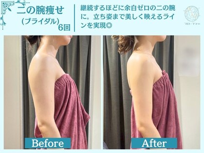フローフシ∞の写真