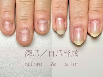 ル リアン 北浦和(le lien)/深爪育成(7ヶ月／8回)