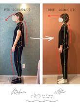 ラクリエ 姫路駅前院(La Creer)/施術ビフォーアフター/猫背/肩