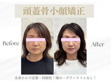 サロン ド グレース(Salon de Grace)の雰囲気（全身バランスを整え理想の小顔へ導く引き上げ本格小顔矯正）