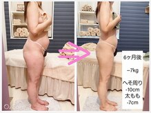 ヴィオラ(Viola)の雰囲気（本格的なサイズダウンご相談ください！無理せず美しく痩身♪）