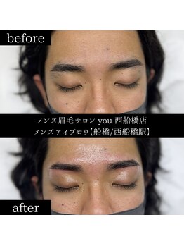 ユー 西船橋店(you)/ビフォーアフター写真