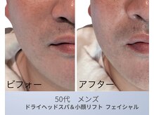 リアン(Lien)の雰囲気(ストレスと疲労は顔に出る。忙しい男性ほどフェイシャルが効く)