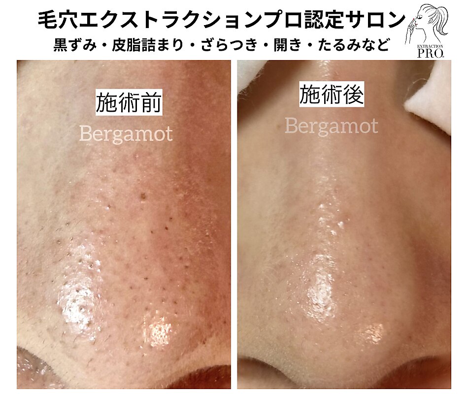 木更津駅で毛穴ケアが人気のエステサロン｜ホットペッパービューティー