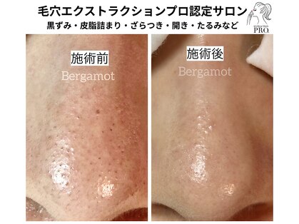 ベルガモットの写真