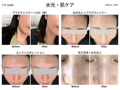 アイムエステ 平塚店(i'm este)の写真