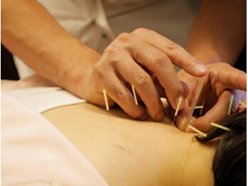 さがみ鍼灸整骨院/鍼灸が初めての方にもオススメ*