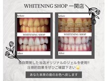 ホワイトニングショップ 一関店/回数を重ねるほどトーンアップ