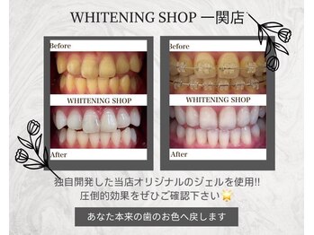 ホワイトニングショップ 一関店/回数を重ねるほどトーンアップ