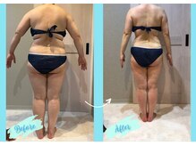 千歳の女神 岡崎店/【施術風景】Before/After