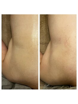 美温(mion)/疲労回復 首肩ゆるませ