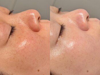 ルーナジェーナ(Luna llena)/