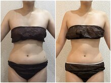 美容整体ウェリナ 名駅院/小顔矯正/骨盤矯正/美脚サロン