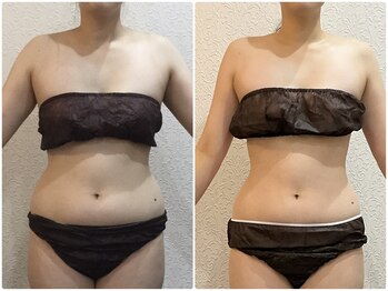 美容整体ウェリナ 名駅院/小顔矯正/骨盤矯正/美脚サロン