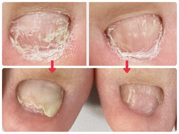 爪処 中野坂上/フットケア