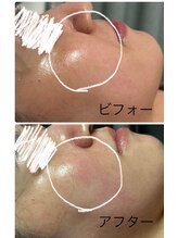 メディカルエステ ユウ(Yuu)/