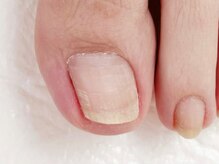 オハナネイル(ohana nail)