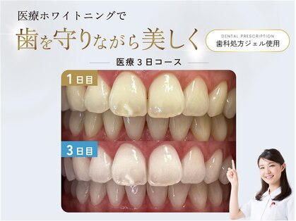 ハイティース 高田馬場店(Hi Teeth!)の写真
