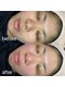 アグライア(Aglaia)の写真/繰り返す毛穴のお悩みがある方にオススメ！お肌の奥から潤いを与え、お肌のトーンアップへと導きます★