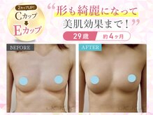 エムエムエム 表参道Luxeサロン(M.M.M)の雰囲気(思春期を過ぎてもまだまだバストアップ可能!モデルも多数来店♪)