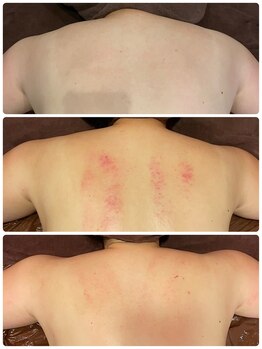 ビューティースタイリング 自由が丘店(beauty styling)/【痩身/ボディ】1部位